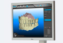 3D画面で歯型の確認