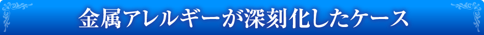 金属アレルギーが深刻化したケース