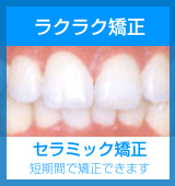 セラミック矯正へ
