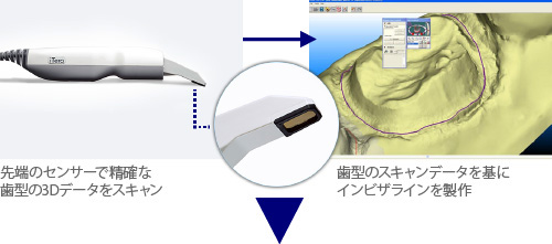 アイテロ施術シーン