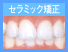 セラミック矯正