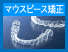 マウスピース矯正