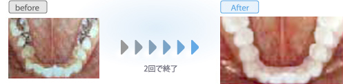 Z~bNNE